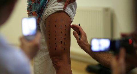 Marking acupressure points on a leg using a pen